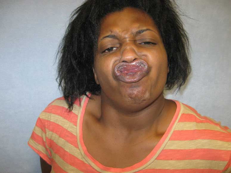 mugshot-duckface
