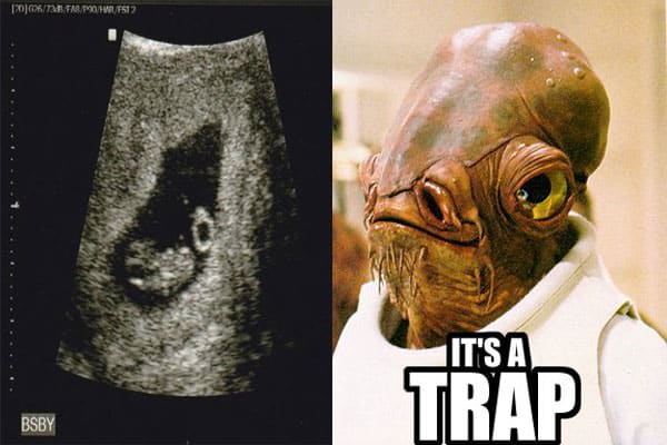 admiral-akbar-sonogram