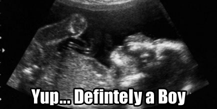 boy-sonogram