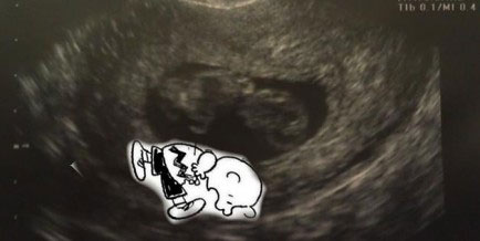 charlie-brown-sonogram