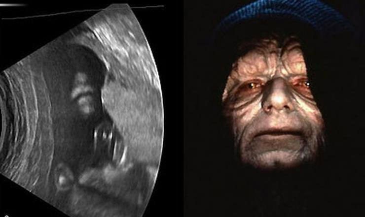 emperor-palpatine-sonogram