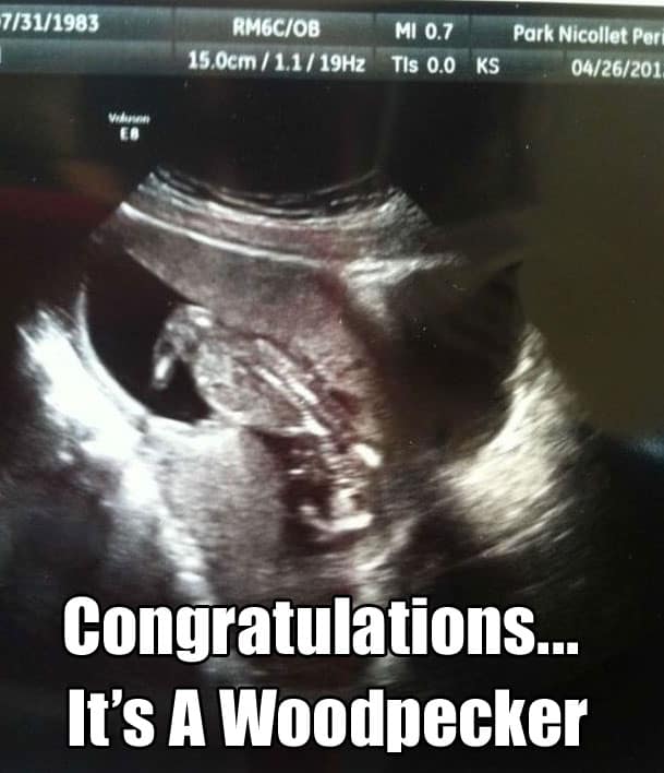 funny-sonogram-photos