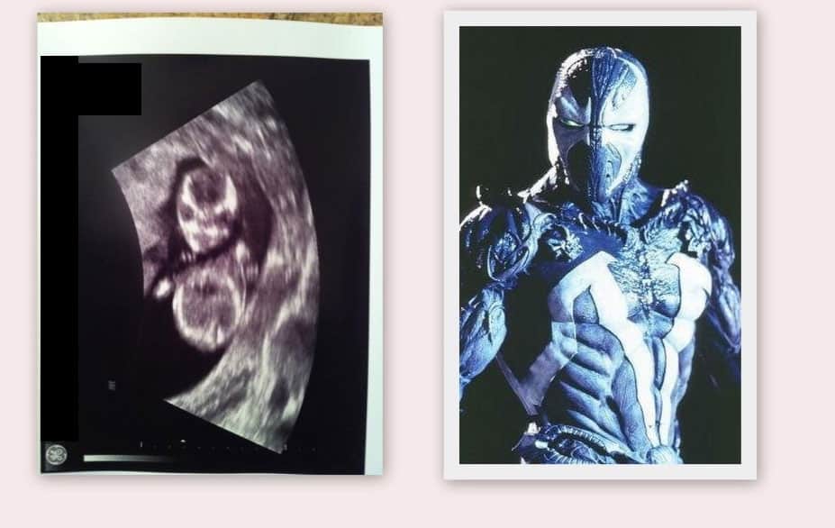 funny-sonogram-pictures