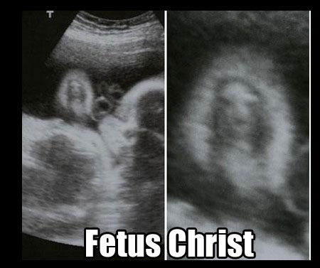 jesus-sonogram
