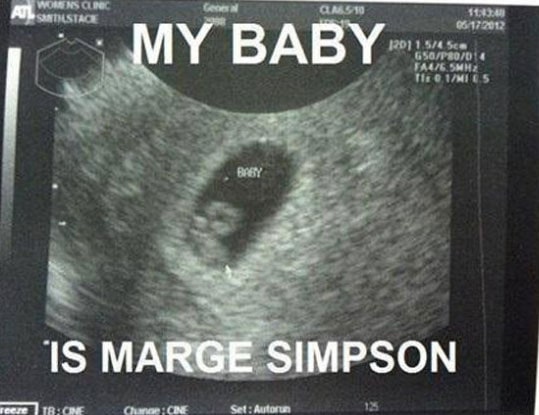 marge-simpson-sonogram