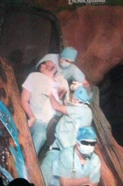 roller coaster surgery