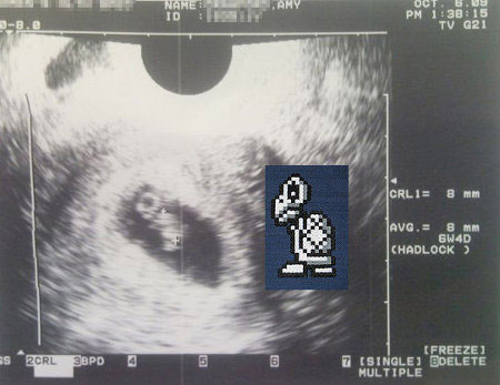 sonogram-funny