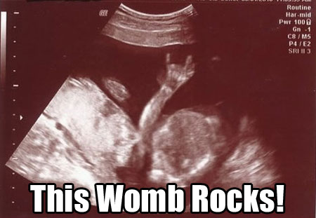 sonogram-meme