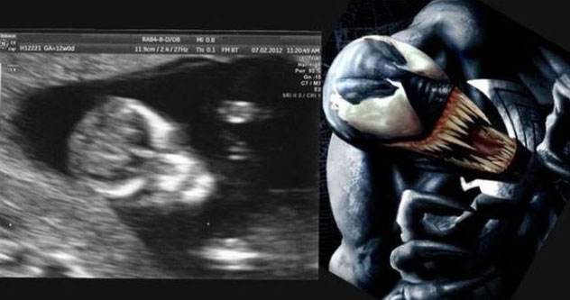 venom-sonogram