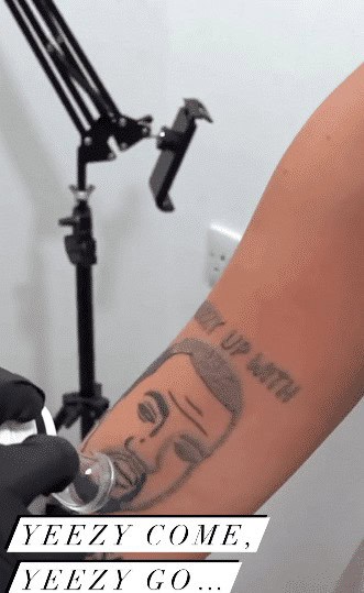kanye west tattoo removal